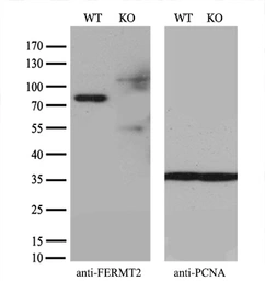 Anti-Mig-2 antibody [25A4] used in Western Blot (WB). GTX84505