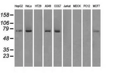 Anti-Mig-2 antibody [25A4] used in Western Blot (WB). GTX84505