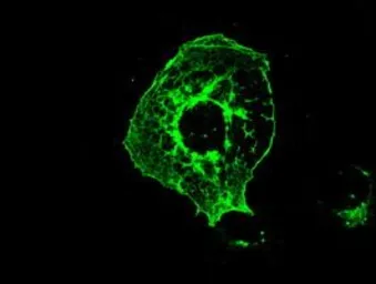 Anti-Mig-2 antibody [14A11] used in Immunocytochemistry/ Immunofluorescence (ICC/IF). GTX84506