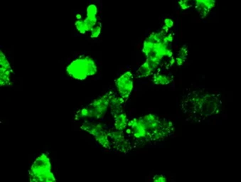 Anti-Mig-2 antibody [14A11] used in Immunocytochemistry/ Immunofluorescence (ICC/IF). GTX84506