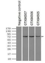 Anti-Mig-2 antibody [14A11] used in Immunoprecipitation (IP). GTX84506