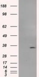 Anti-CD32a antibody [20D1] used in Western Blot (WB). GTX84508