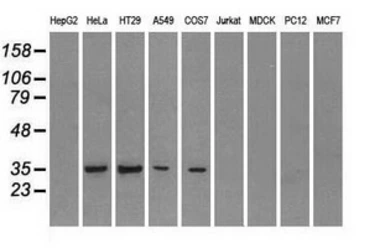 Anti-CD32a antibody [20D1] used in Western Blot (WB). GTX84508