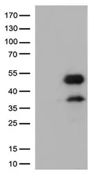 Anti-CD32a antibody [16E7] used in Western Blot (WB). GTX84518