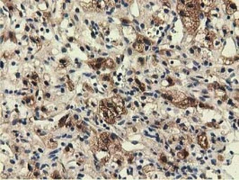 Anti-EPXH2 antibody [1A6] used in IHC (Paraffin sections) (IHC-P). GTX84570
