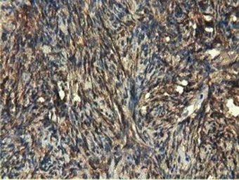 Anti-EPXH2 antibody [1A6] used in IHC (Paraffin sections) (IHC-P). GTX84570