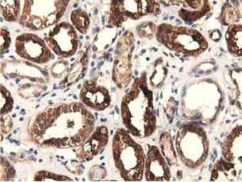Anti-EPXH2 antibody [1A6] used in IHC (Paraffin sections) (IHC-P). GTX84570