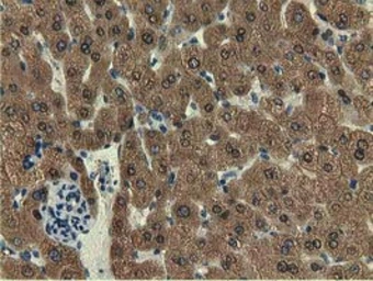 Anti-EPXH2 antibody [1A6] used in IHC (Paraffin sections) (IHC-P). GTX84570