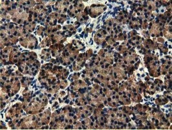 Anti-EPXH2 antibody [1A6] used in IHC (Paraffin sections) (IHC-P). GTX84570