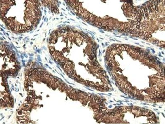 Anti-EPXH2 antibody [1A6] used in IHC (Paraffin sections) (IHC-P). GTX84570