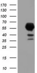 Anti-EPXH2 antibody [1A6] used in Western Blot (WB). GTX84570