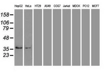 Anti-EpCAM antibody [2C8] used in Western Blot (WB). GTX84572