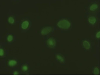 Anti-EpCAM antibody [2H9] used in Immunocytochemistry/ Immunofluorescence (ICC/IF). GTX84573