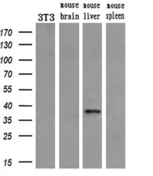 Anti-EpCAM antibody [2H9] used in Western Blot (WB). GTX84573