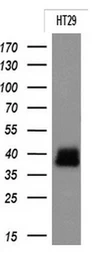 Anti-EpCAM antibody [2H9] used in Western Blot (WB). GTX84573