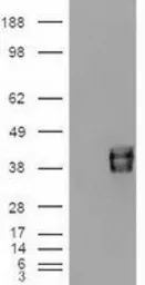 Anti-EpCAM antibody [2H9] used in Western Blot (WB). GTX84573