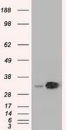 Anti-EMG1 antibody [1B8] used in Western Blot (WB). GTX84576