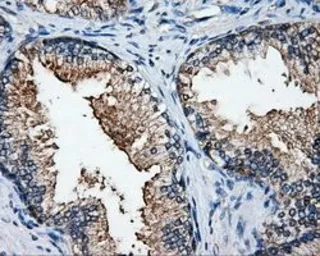 Anti-ELAVL1 / HuR antibody [14F4] used in IHC (Paraffin sections) (IHC-P). GTX84577