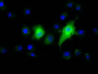 Anti-Ephrin A2 antibody [4C3] used in Immunocytochemistry/ Immunofluorescence (ICC/IF). GTX84590