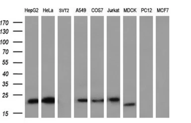 Anti-Ephrin A2 antibody [2D6] used in Western Blot (WB). GTX84591