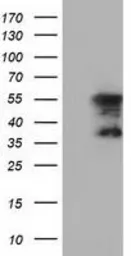 Anti-DYNC1LI1 antibody [2B6] used in Western Blot (WB). GTX84599