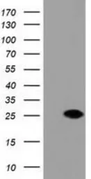 Anti-DUSP27 antibody [1E7] used in Western Blot (WB). GTX84600