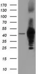 Anti-DNAJA2 antibody [3H10] used in Western Blot (WB). GTX84609