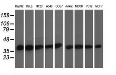 Anti-DNAJA2 antibody [3H10] used in Western Blot (WB). GTX84609