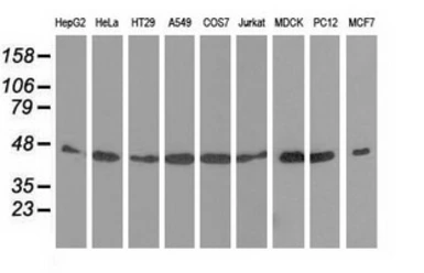 Anti-DNAJA2 antibody [3A1] used in Western Blot (WB). GTX84610