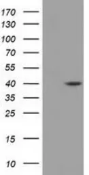 Anti-DHPS antibody [2C9] used in Western Blot (WB). GTX84616
