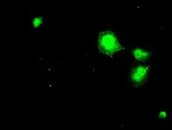 Anti-DHFR antibody [6G7] used in Immunocytochemistry/ Immunofluorescence (ICC/IF). GTX84617