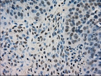 Anti-DHFR antibody [6G7] used in IHC (Paraffin sections) (IHC-P). GTX84617