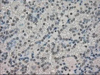 Anti-DHFR antibody [6G7] used in IHC (Paraffin sections) (IHC-P). GTX84617