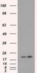 Anti-DHFR antibody [6G7] used in Western Blot (WB). GTX84617