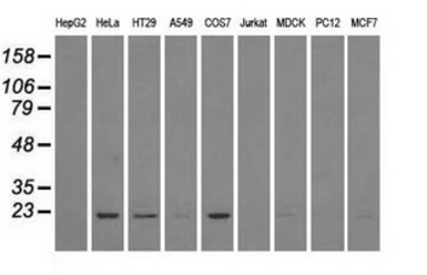 Anti-DHFR antibody [6G7] used in Western Blot (WB). GTX84617