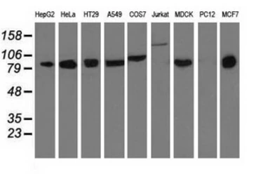 Anti-DGKB antibody [1F9] used in Western Blot (WB). GTX84619