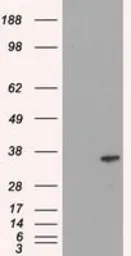 Anti-ICAD antibody [3F12] used in Western Blot (WB). GTX84620