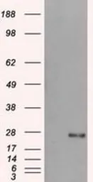 Anti-DCXR antibody [4D11] used in Western Blot (WB). GTX84623