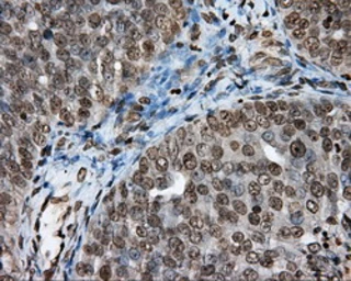 Anti-DAP Kinase 2 antibody [1F7] used in IHC (Paraffin sections) (IHC-P). GTX84630