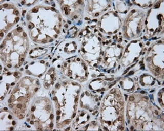 Anti-DAP Kinase 2 antibody [1F7] used in IHC (Paraffin sections) (IHC-P). GTX84630