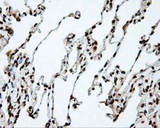 Anti-DAP Kinase 2 antibody [1F7] used in IHC (Paraffin sections) (IHC-P). GTX84630