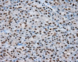 Anti-DAP Kinase 2 antibody [1F7] used in IHC (Paraffin sections) (IHC-P). GTX84630