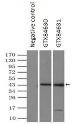 Anti-DAP Kinase 2 antibody [1F7] used in Immunoprecipitation (IP). GTX84630
