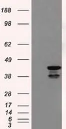 Anti-DAP Kinase 2 antibody [1F7] used in Western Blot (WB). GTX84630