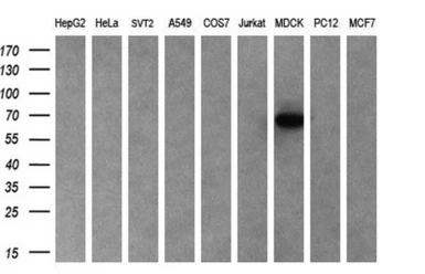Anti-Cyp7b1 antibody [7H10] used in Western Blot (WB). GTX84633