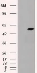 Anti-Cyp7b1 antibody [7H10] used in Western Blot (WB). GTX84633