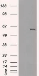 Anti-CYP2E1 antibody [5B9] used in Western Blot (WB). GTX84636