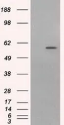 Anti-CYP1A2 antibody [6E2] used in Western Blot (WB). GTX84639