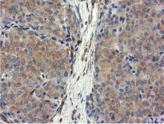 Anti-CYB5R3 antibody [2A10] used in IHC (Paraffin sections) (IHC-P). GTX84646