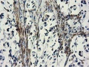 Anti-CYB5R3 antibody [2A10] used in IHC (Paraffin sections) (IHC-P). GTX84646